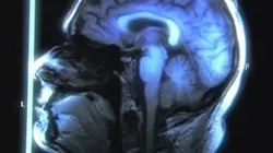 Visuel de Les étonnants pouvoirs de transformation du cerveau