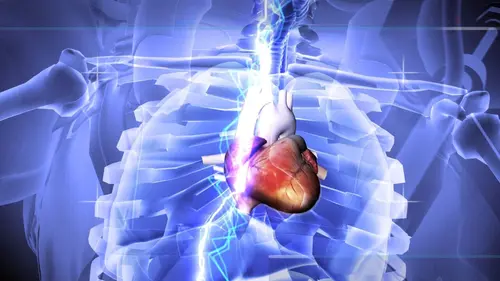 Les indestructibles Electrocuté dans les airs