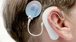 Les mécanismes de l'audition : Une ouïe très fine