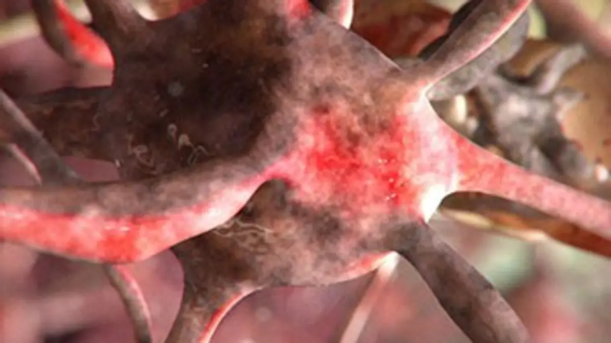 Les monstres en moi S05E08 Mon corps en putréfaction