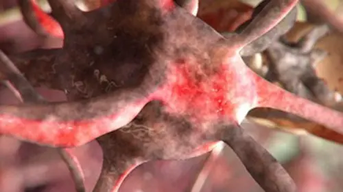 Les monstres en moi S05E08 Mon corps en putréfaction