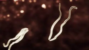 Les monstres en moi S03E04 Mon parasite dévoreur de visage