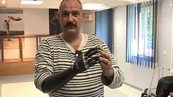 Ma nouvelle main bionique