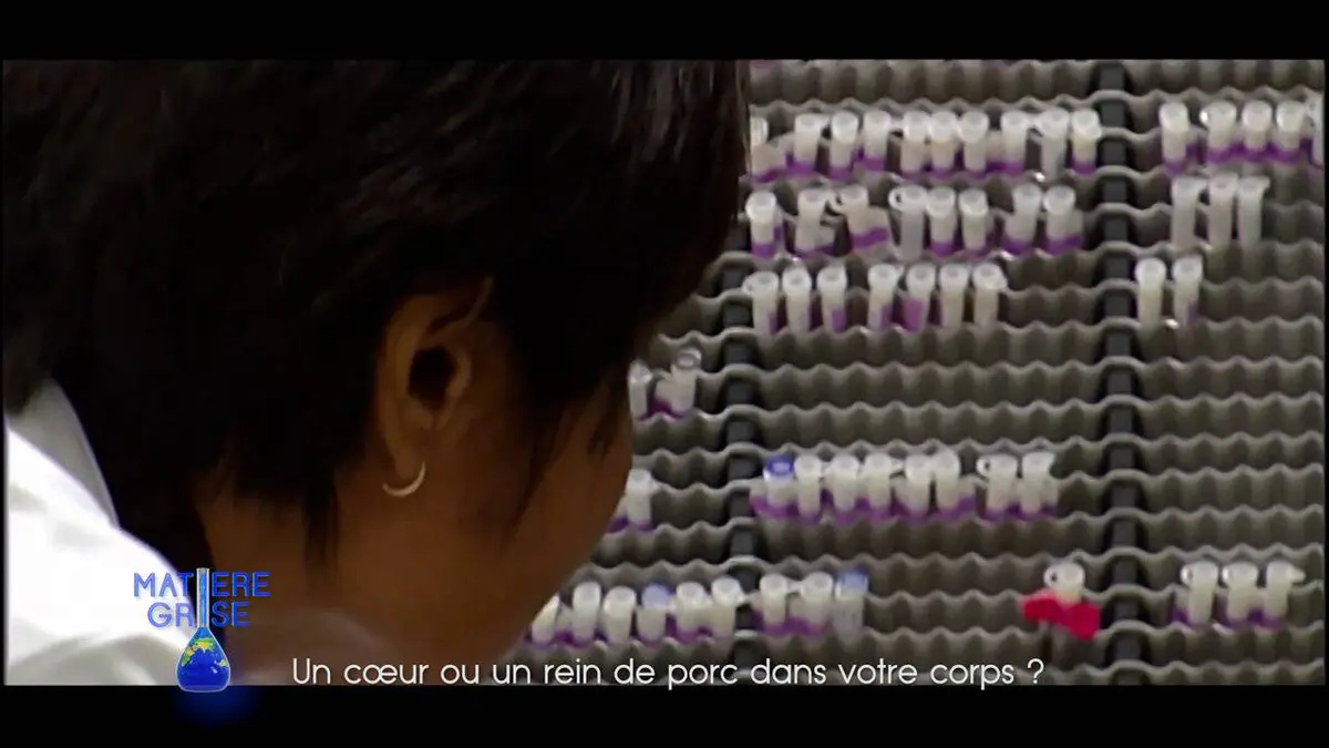 Matière grise Un coeur ou un rein de porc dans votre corps ?