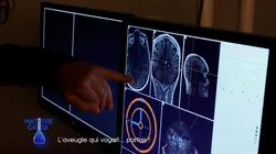 Matière grise L'aveugle qui voyait...parfois !