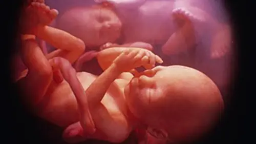 Miracles in utero