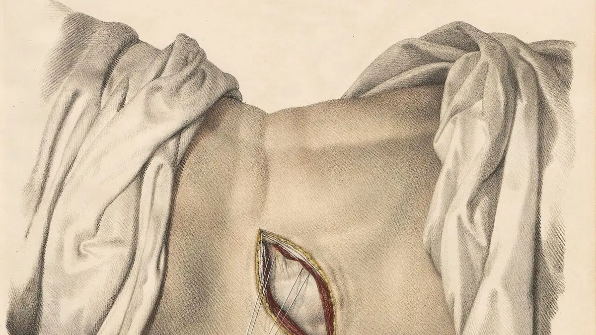 Nôt - en direct du Festival d'Avignon