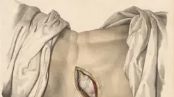 Nôt - en direct du Festival d'Avignon