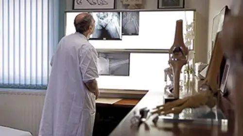 Ostéoporose, il y a comme un os