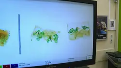 Patrouille frontalière Nouvelle-Zélande Body Packer Widow