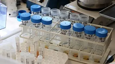 Pièces à conviction Tous dopés