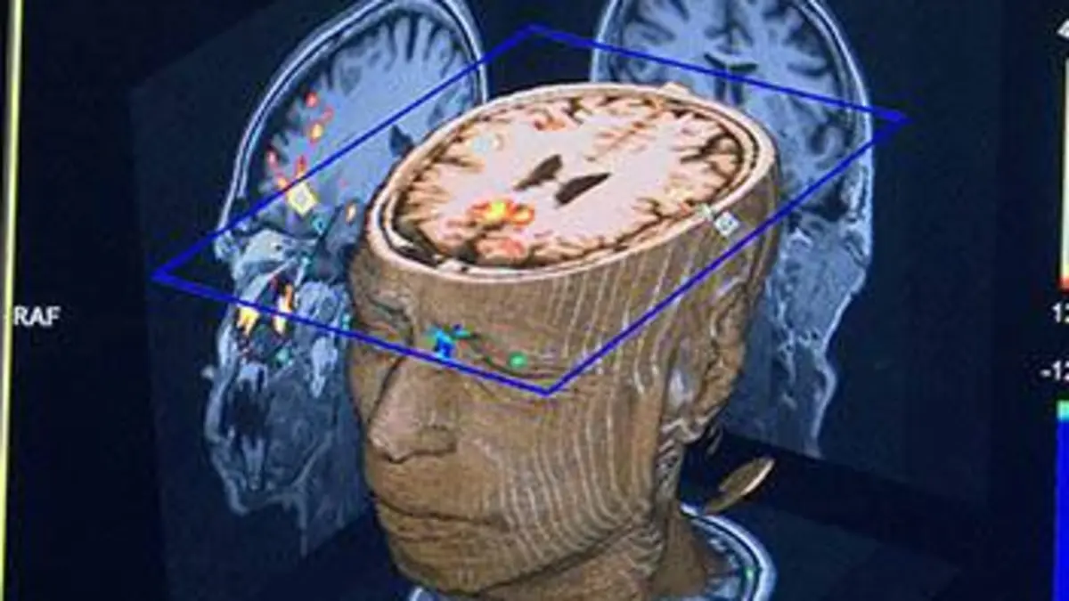 Poétique du cerveau
