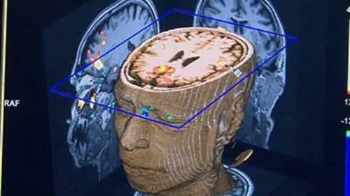 Poétique du cerveau