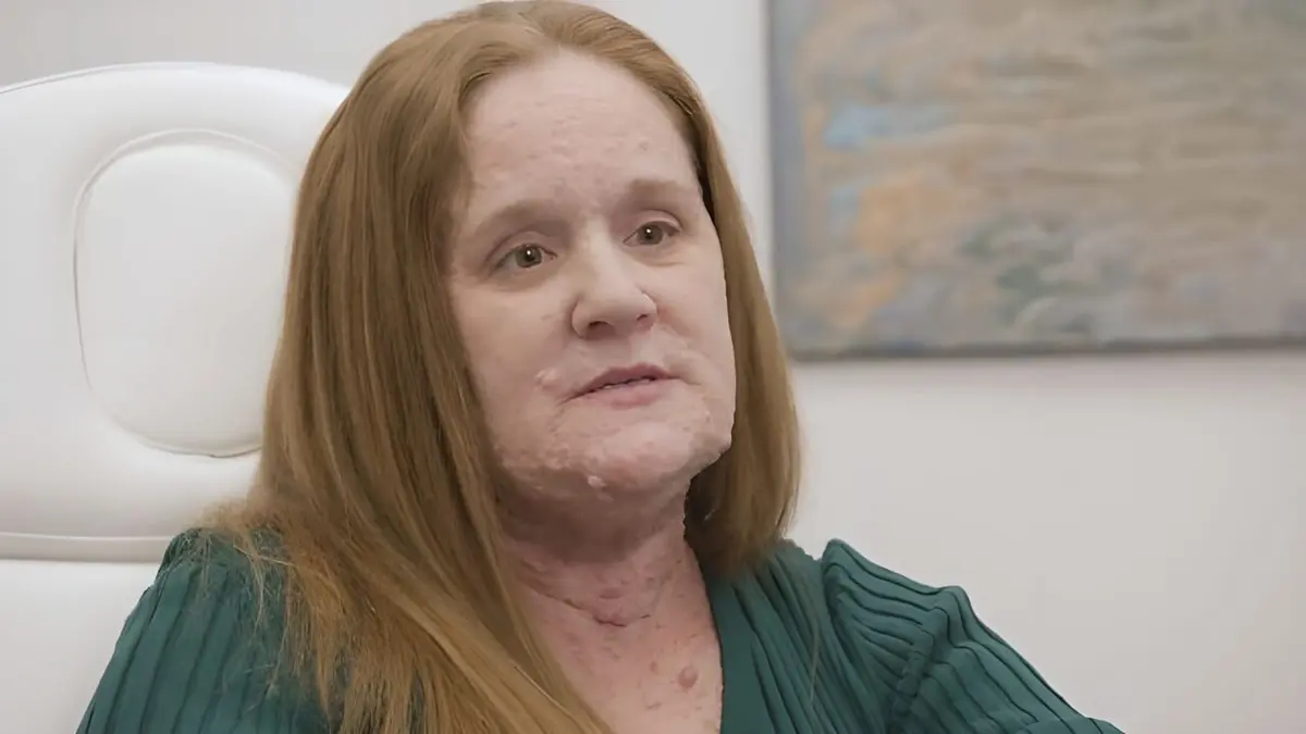 Reconstruire leurs visages Des tumeurs par milliers