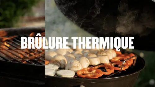 Réflexe ! Brûlure thermique replay