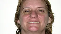Visuel de Relooking extrême
