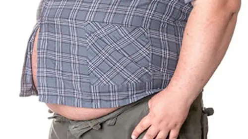 Relooking extrême : spécial obésité Mike (1/2)