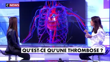 Bonjour Dr Milhau du 20/03/2021
