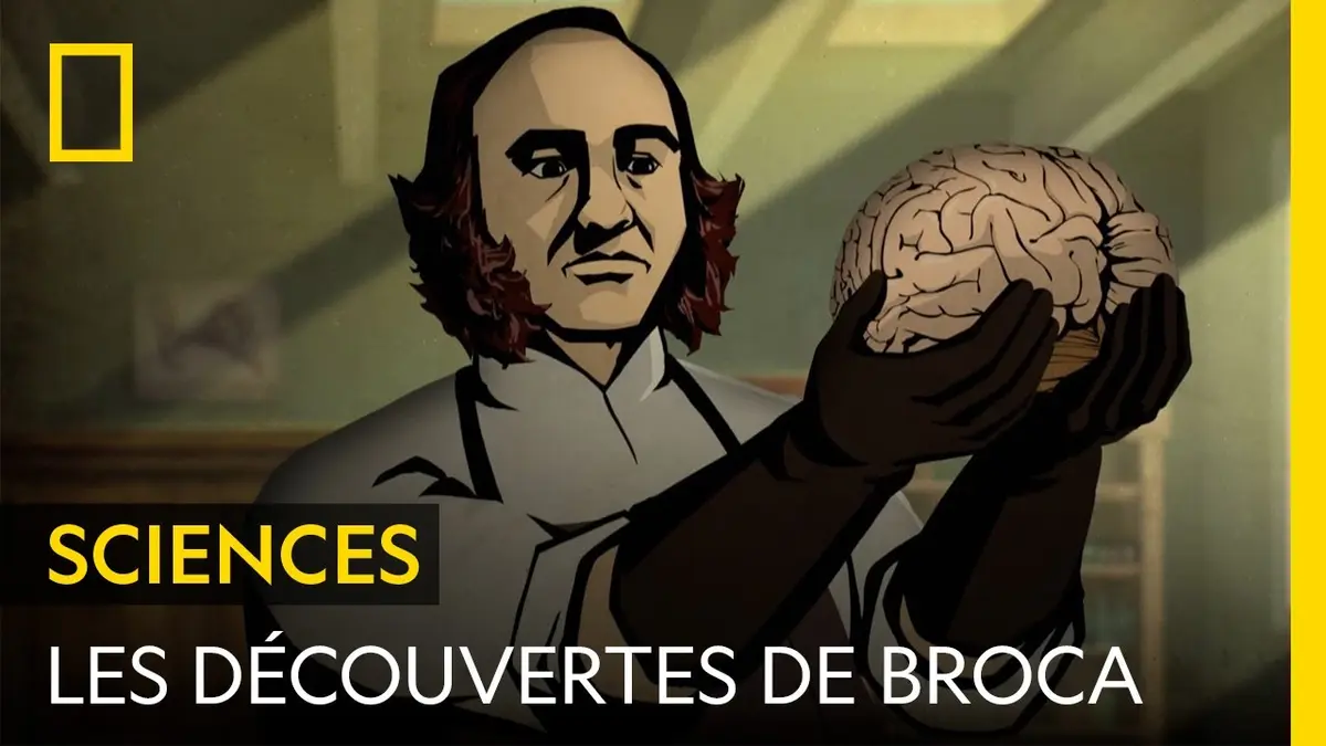Connaissez-vous Paul Broca, le chirurgien qui a…