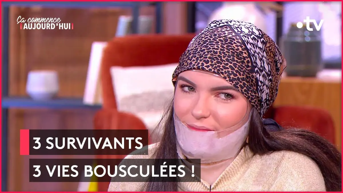 replay de Grands brûlés : comment réussir à accepter sa nouvelle apparence ? - Ça commence aujourd'hui