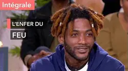 Grands brûlés : quelle force de caractère pour se reconstruire ! - Ça commence aujourd'hui