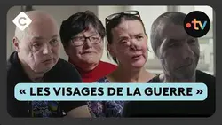 La lente réparation des gueules cassées en Ukraine - La Story de Louis Amar