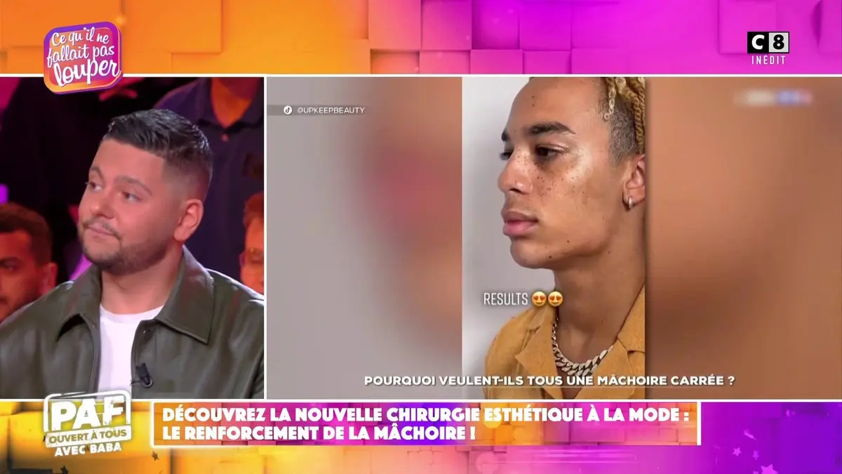 replay de La nouvelle chirurgie esthétique à la mode : le renforcement de la mâchoire !