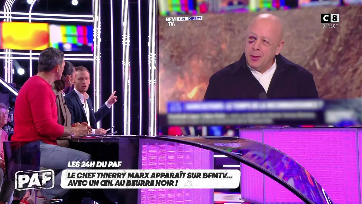replay de Le chef Thierry Marx apparaît à l'antenne avec un œil au beurre noir !