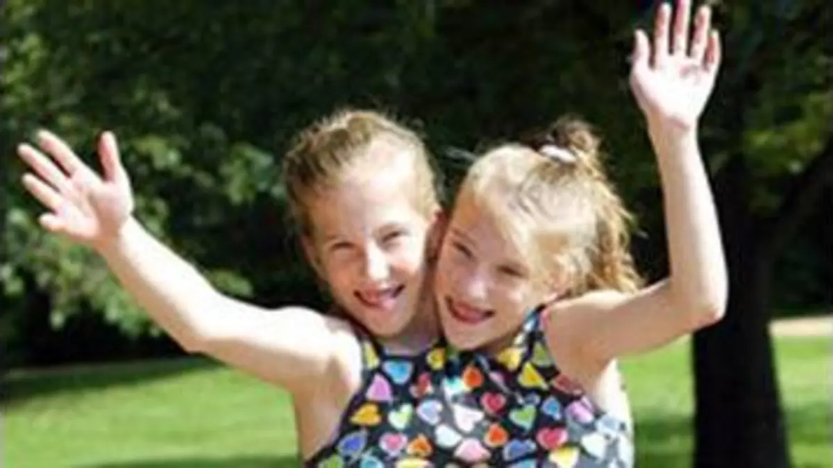 replay de Les soeurs siamoises : Les soeurs siamoises