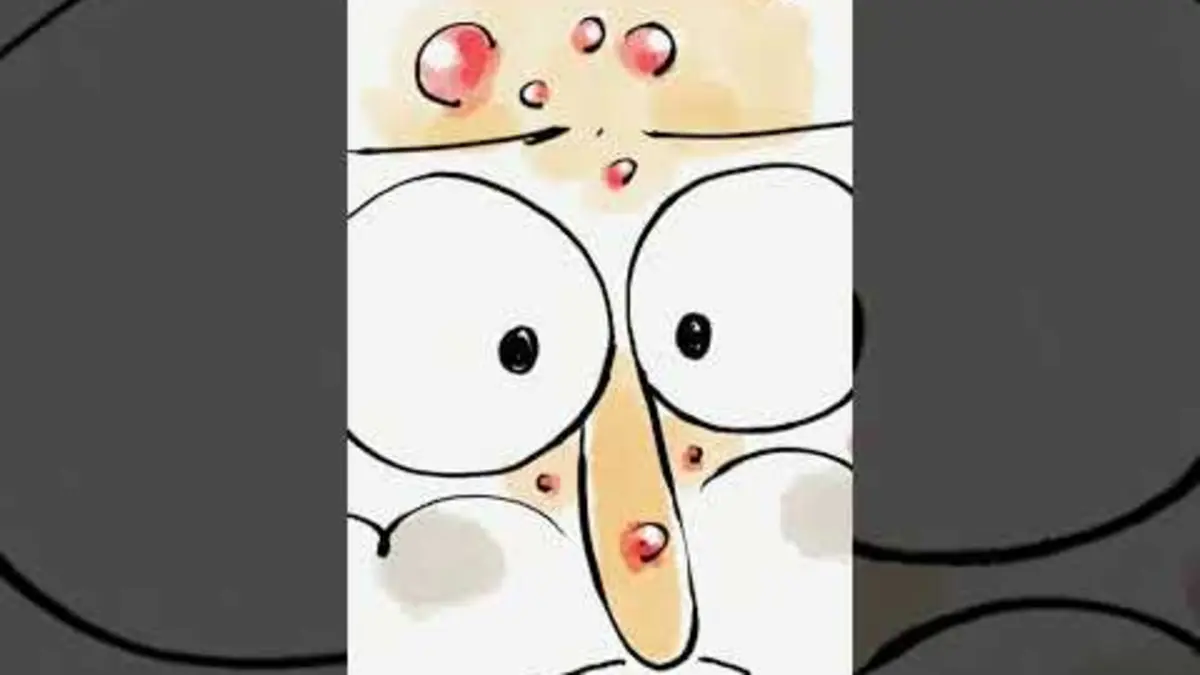 replay de ? Mais d'où viennent vos boutons ? #humour #acne