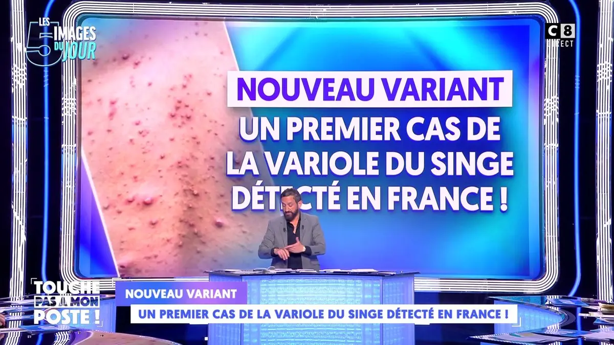 replay de Nouveau variant : un premier cas de la variole du singe détecté en France !