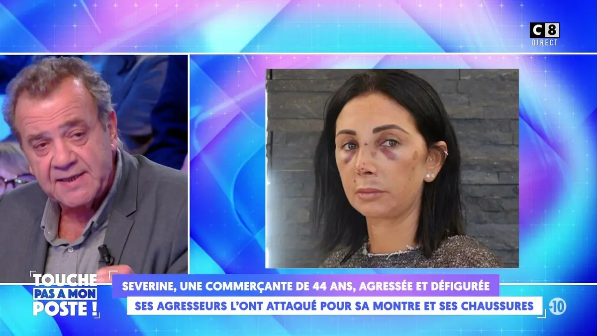 replay de Séverine, une commerçante de 44ans, agressée et défigurée pour sa montre et ses chaussures