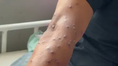 Sur la piste des nouveaux virus