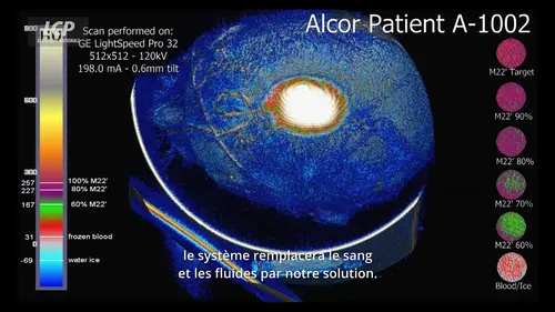 replay de Tuer la mort ?