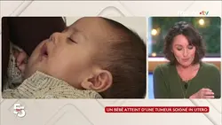 Un bébé atteint d’une tumeur soigné in utero - Le 5/5 de d’Amandine Bégot