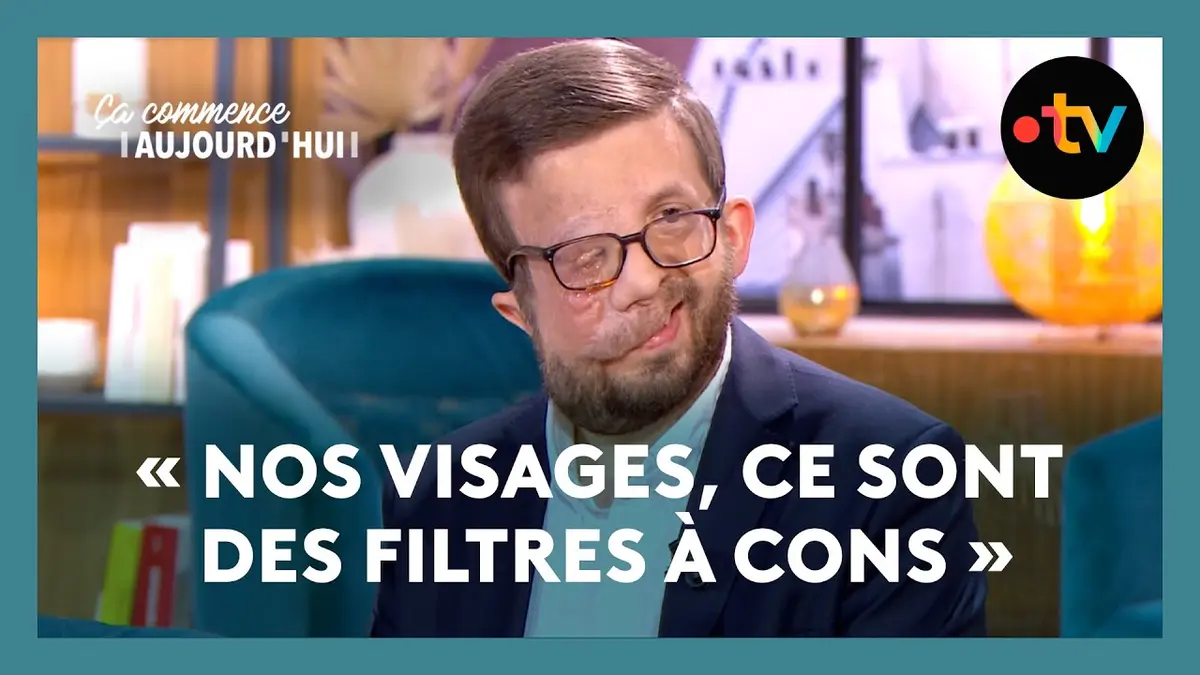 replay de Vivre avec un visage pas comme les autres - Ça commence aujourd'hui