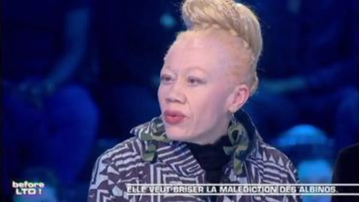 replay de Adine Ntankeu - Elle veut briser la malédiction des albinos