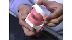 Comment c'est fait - Les Prothèses Dentaires