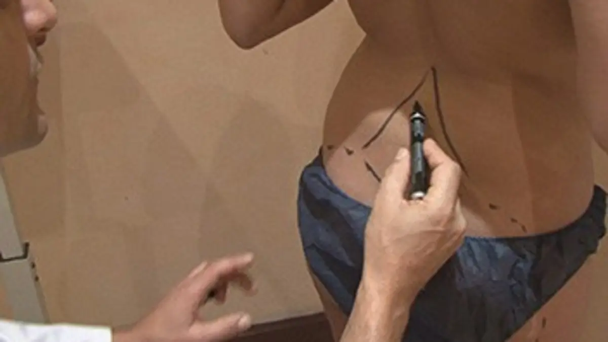 Révélations Chirurgie esthétique : être jeune à tout prix