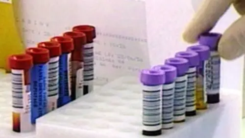 Sang contaminé : l'autre scandale