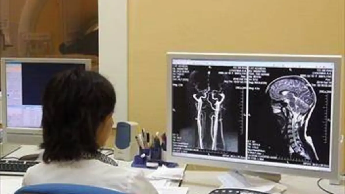 Schizophrénie, l'envers de la raison