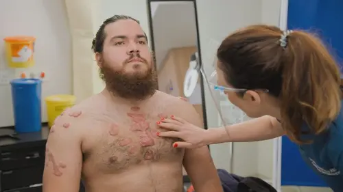 SOS Dermato Je rêve d'avoir un corps normal