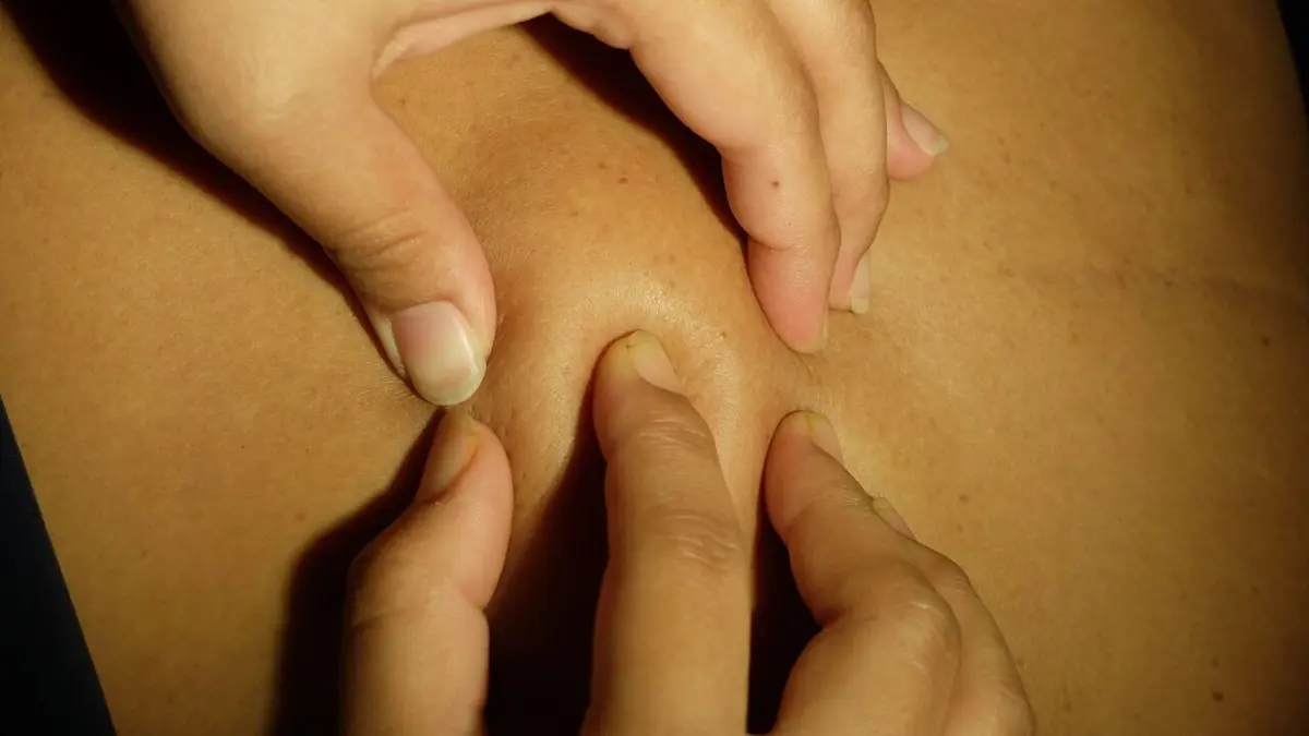 SOS Dermato On dirait qu'il va exploser