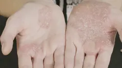 SOS Dermato