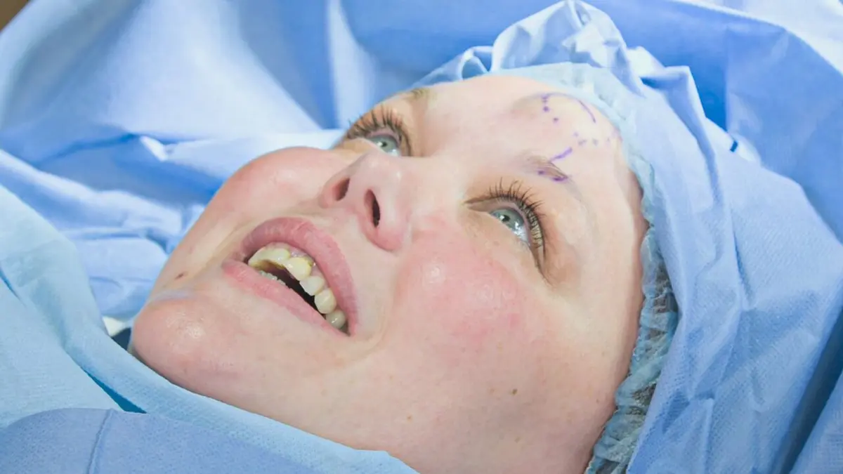 SOS Dermato Najib, Antony, Annmarie et Sam