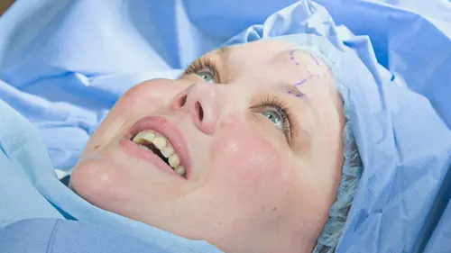 SOS Dermato Najib, Antony, Annmarie et Sam