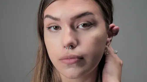 SOS Dermato Caroline Antony Cerys et Dan