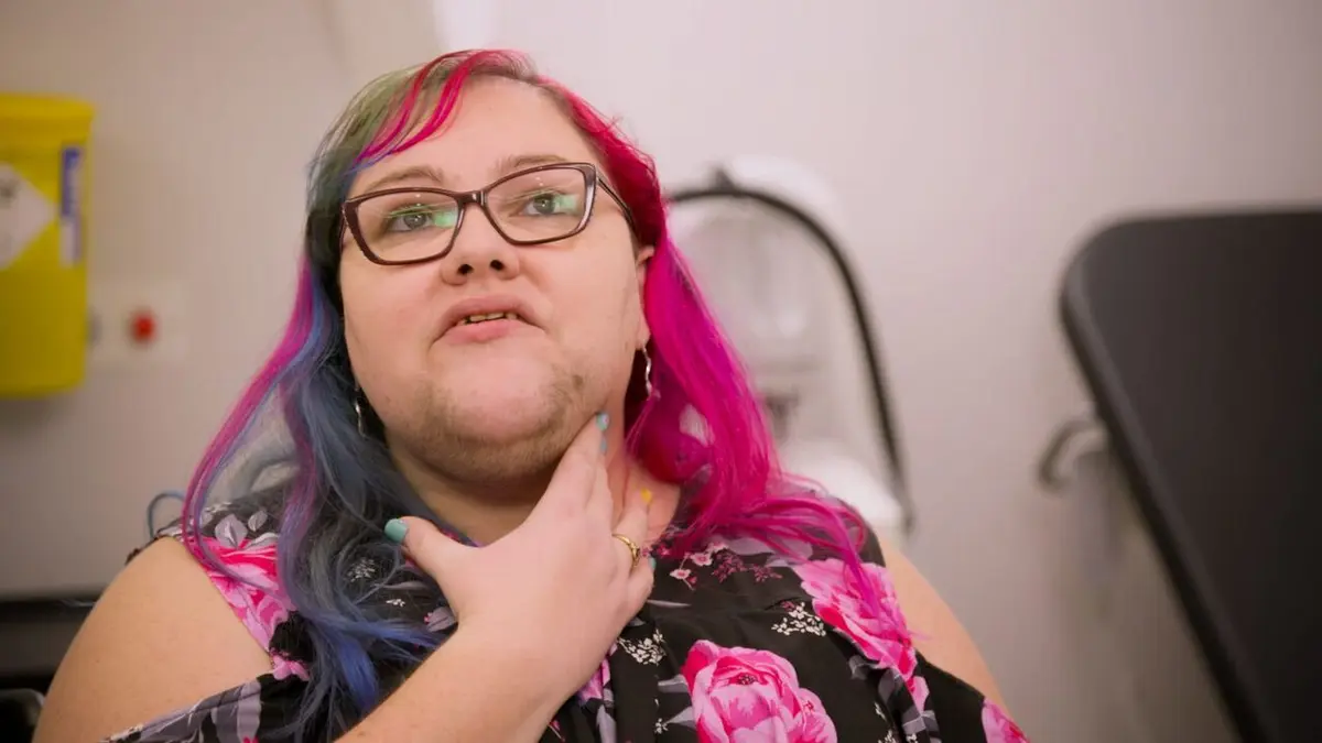 SOS Dermato L'impression d'être un monstre de foire