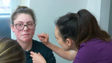 Eczema-stential Crisis