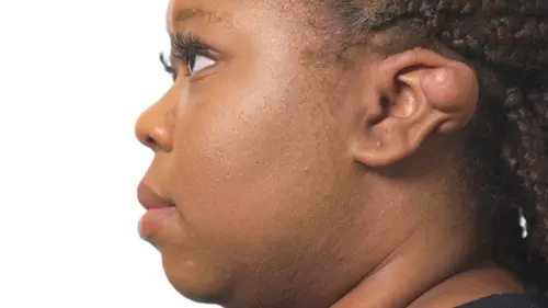 SOS Dermato Elise, Gary, Onique & Callum